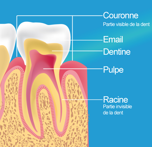 Dévitalisation-Traitement endodontique Paris 13